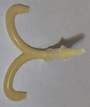 注塑產品缺陷料頭附近有暗區的理解 注塑產品缺陷料頭附近有暗區的理解